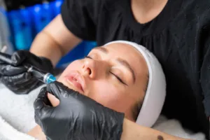 HydraFacial Skin Treatment in North London