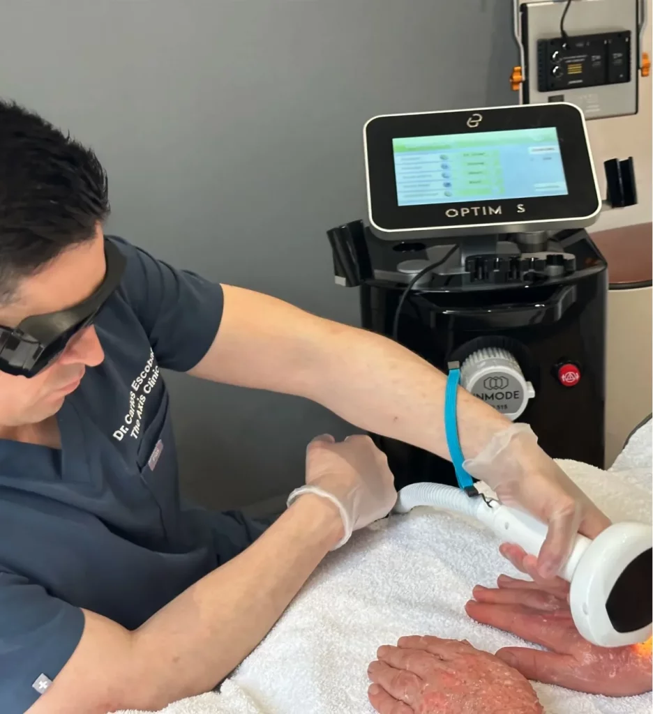 Lumecca London – IPL Skin Rejuvenation & Pigmentation Treatment | The Axis Clinic