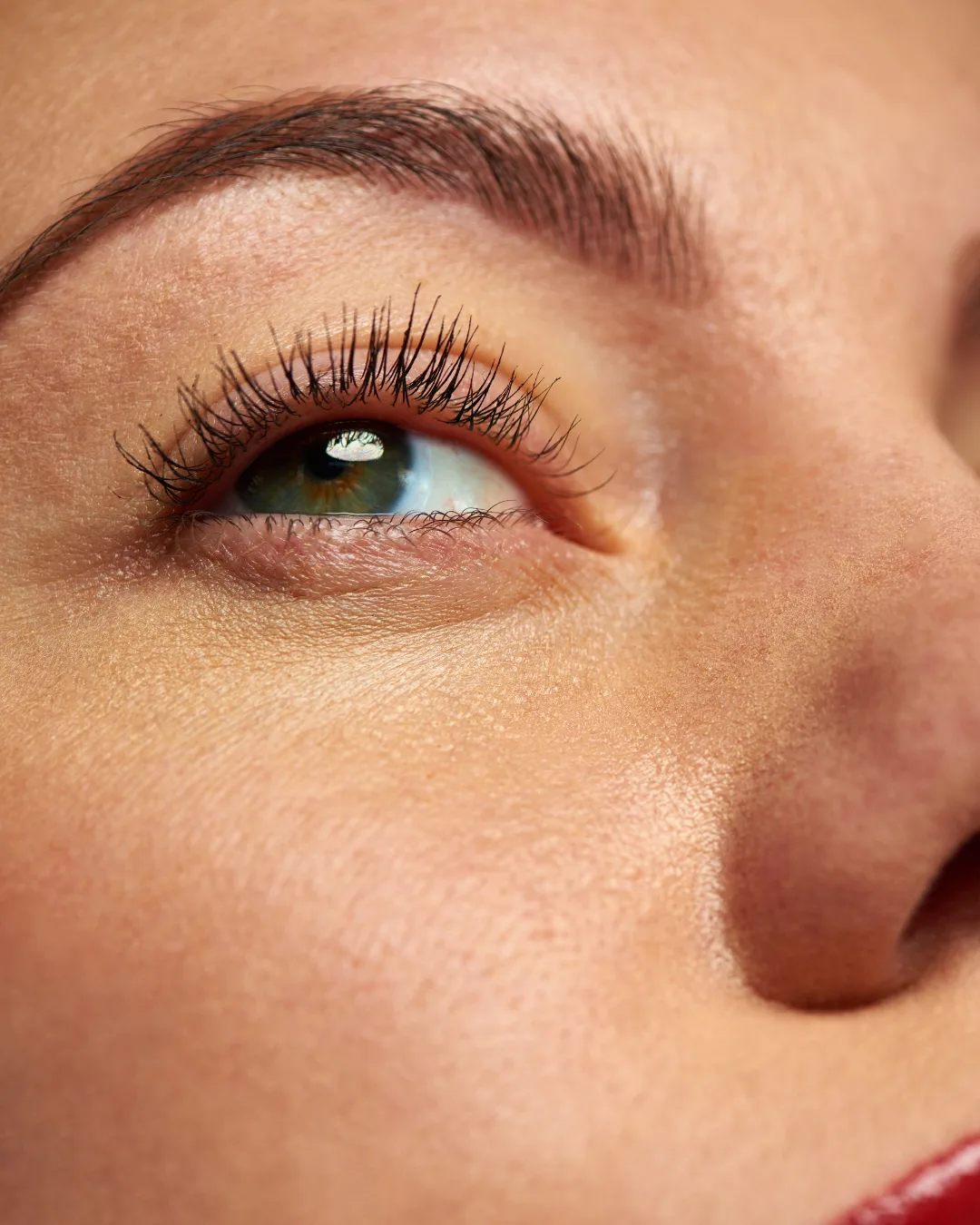 Woman with dry and dehydrated skin before treatment at Axis Clinic London