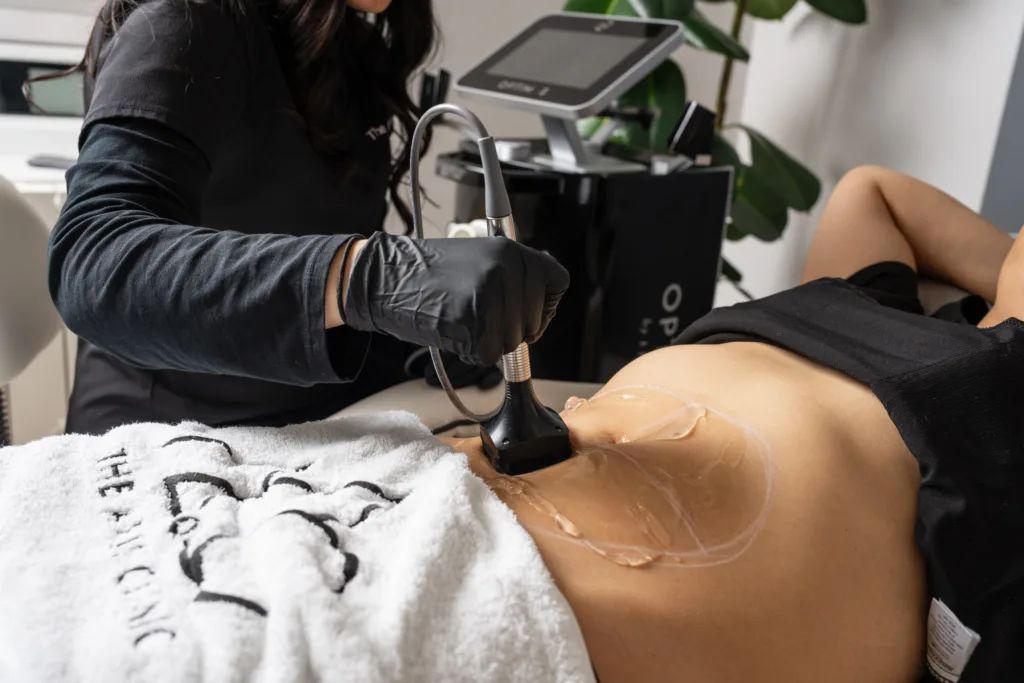 Forma RF skin tightening treatment being performed at The Axis Clinic in North London