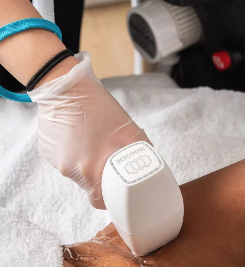 Laser Hair Removal results at The Axis Clinic London