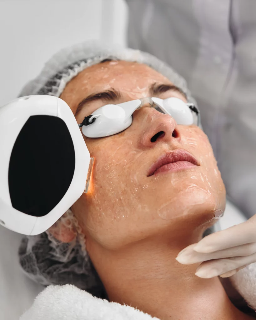 Patient receiving Lumecca IPL skin rejuvenation treatment at The Axis Clinic in Crouch End, London