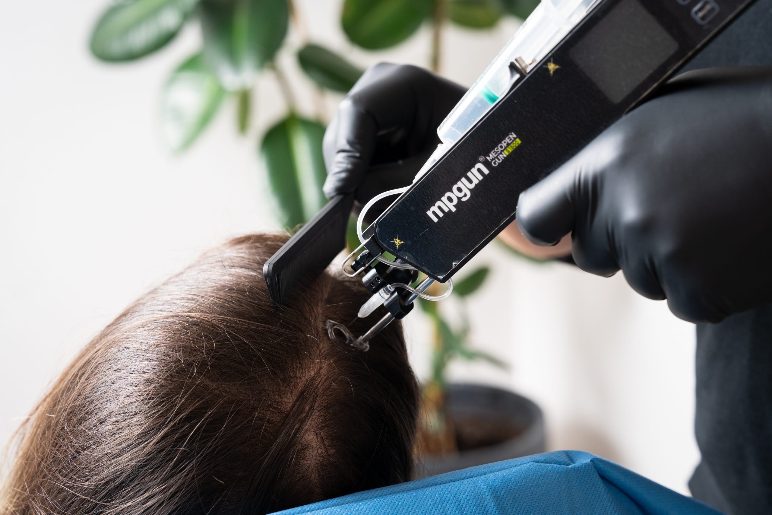 PRP treatment being performed at The Axis Clinic in North London to rejuvenate and restore skin health