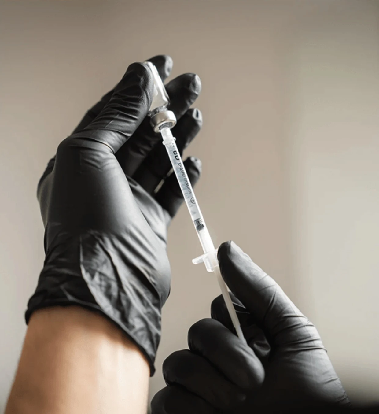 Patient receiving Radiesse injectable treatment at The Axis Clinic London