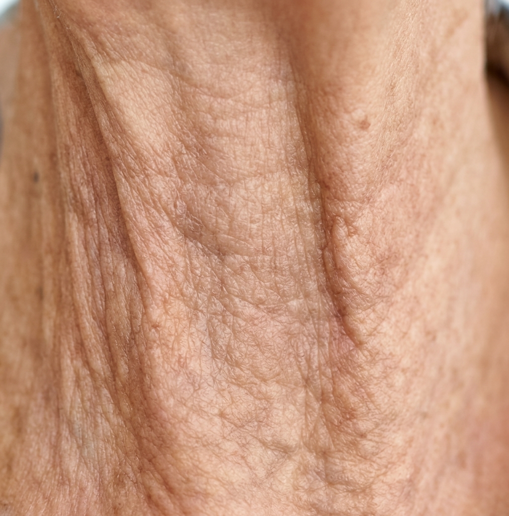 Before: Juvelook neck wrinkle treatment before and after