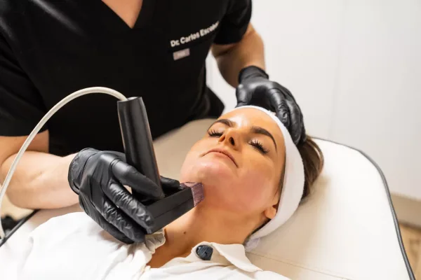 What Is Morpheus8 Radiofrequency Microneedling?